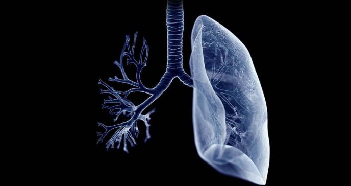 Bronquiolitis obliterante: una enfermedad pulmonar obstructiva rara
