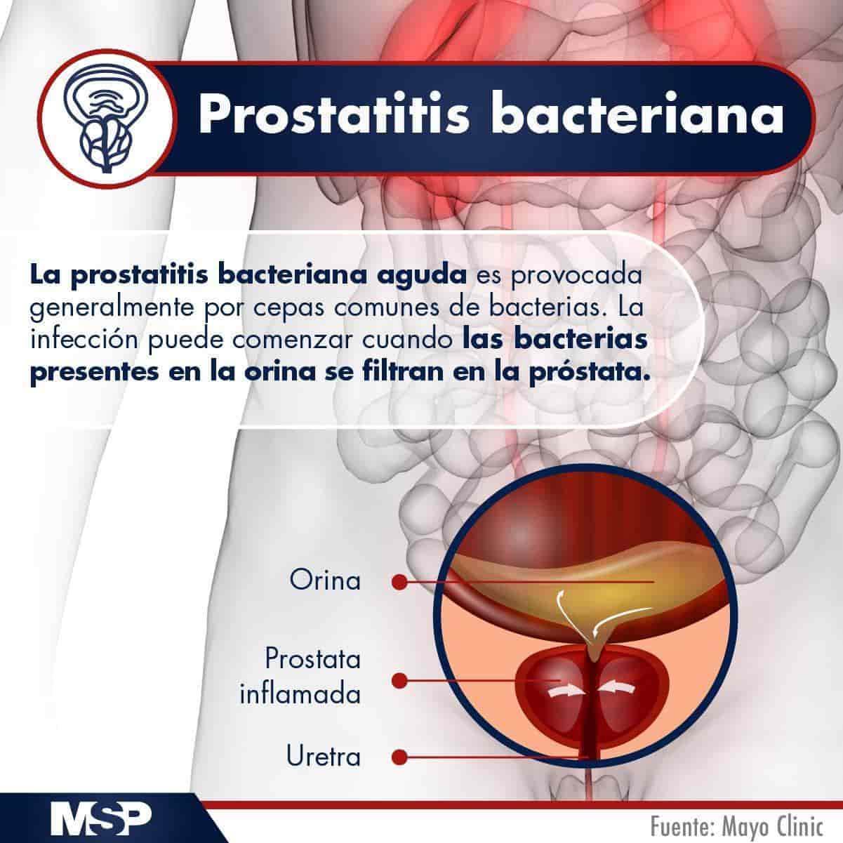 prosztatitis és bélrendszeri betegség