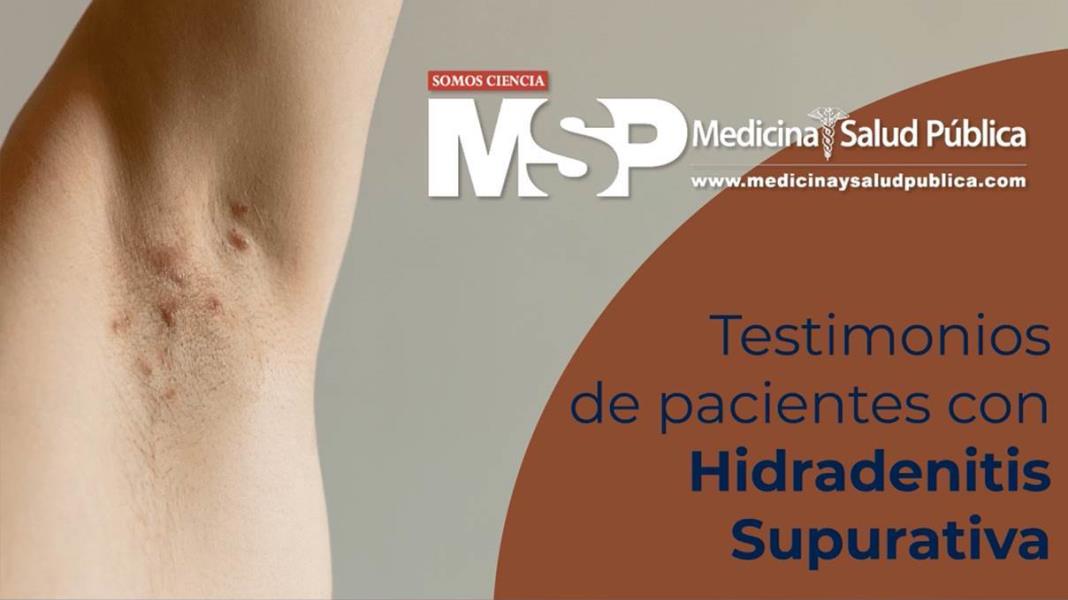 Testimonios De Pacientes De Hidradenitis Supurativa