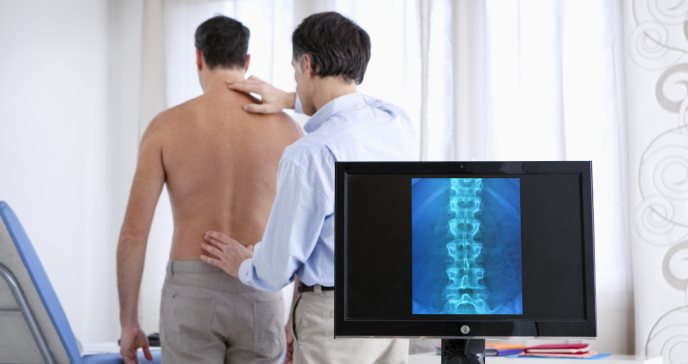 Espondilitis Anquilosante: más que un simple dolor en la espalda