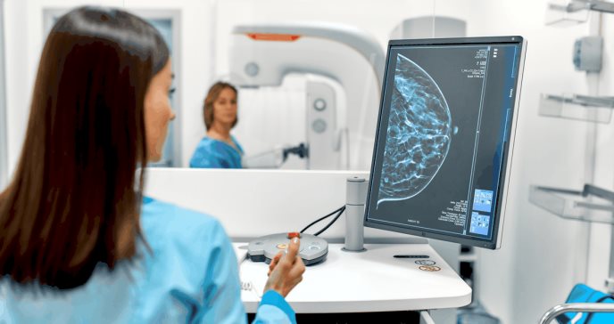 Inteligencia artificial ayudaría a detectar el cáncer de mama de una forma más precisa
