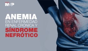 #ExclusivoMSP - Anemia en enfermedad renal crónica y síndrome Nefrótico