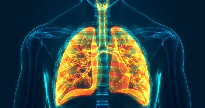 Itepekimab, un nuevo anticuerpo monoclonal que sería beneficioso para el asma grave