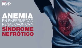#ExclusivoMSP - Anemia en enfermedad renal crónica y síndrome Nefrótico