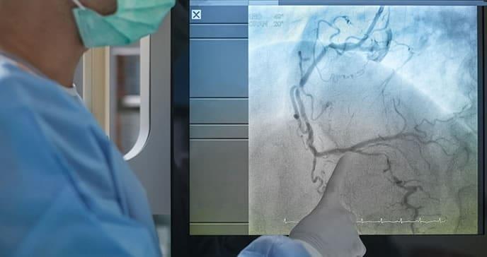 Miocardiopatía hipertrófica: El reto diagnóstico y terapéutico