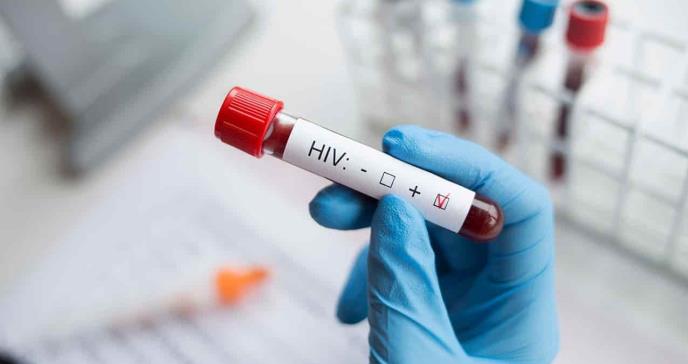 VIH se relaciona con riesgo mayor de hospitalización por COVID-19 y muerte