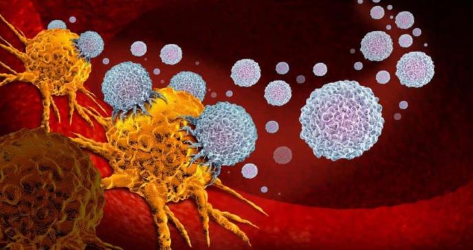 Hay mayor supervivencia con inmunoterapia combinada en el melanoma avanzado, según estudio