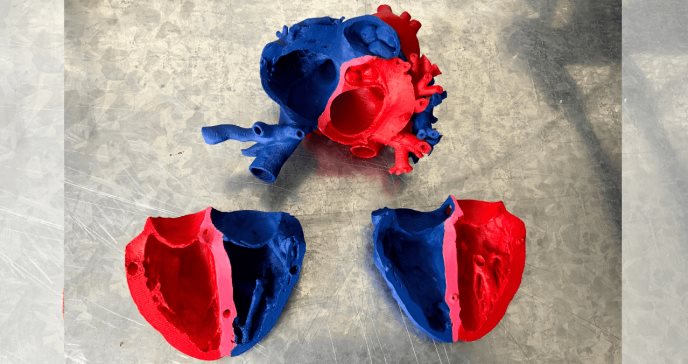 Impresión en 3D, un método para el tratamiento de patologías en el organismo de alta complejidad