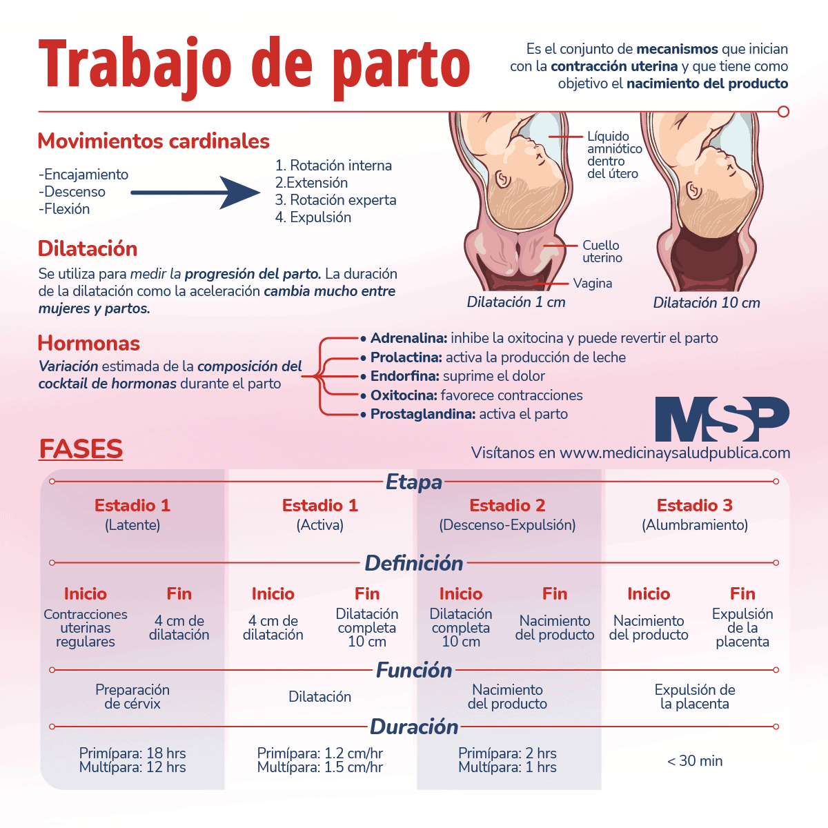 Trabajo De Parto Infografía 1680