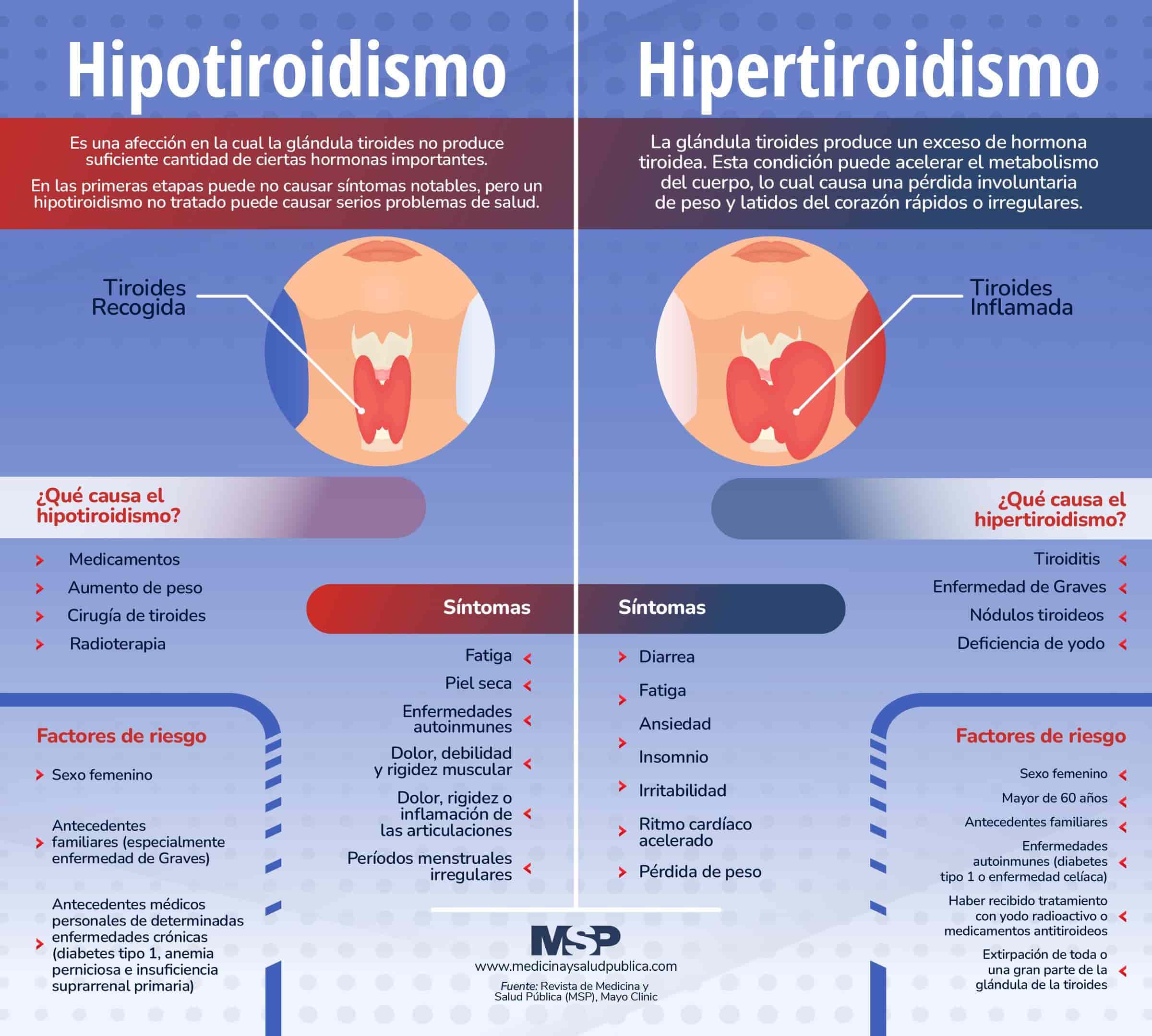 Infografia Tiroides Hipotiroidismo E Hipertiroidismo - vrogue.co