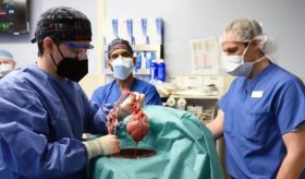 Los dilemas éticos que generan los trasplantes de órganos provenientes de cerdos