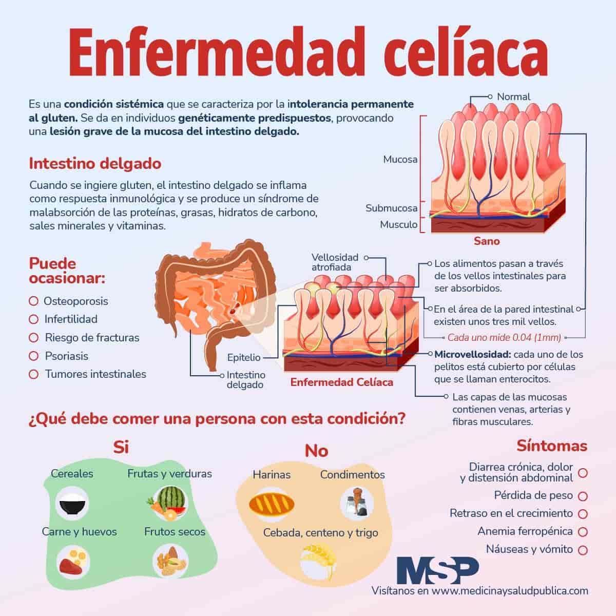 Enfermedad Cel Aca Infograf A