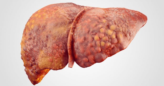 Cemiplimab promete ser eficaz contra el cáncer de hígado resecable