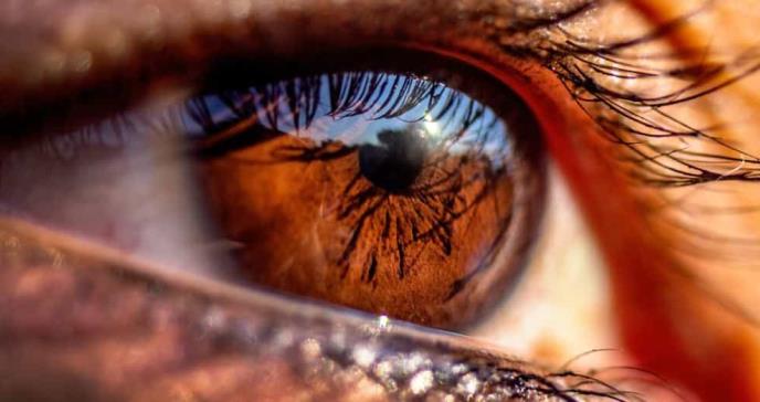 Síntomas oculares en pacientes con rosácea