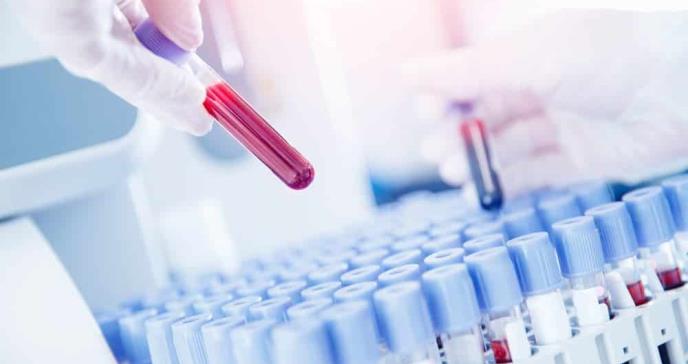 Biopsia líquida: nuevo test detecta el cáncer de mama en la sangre
