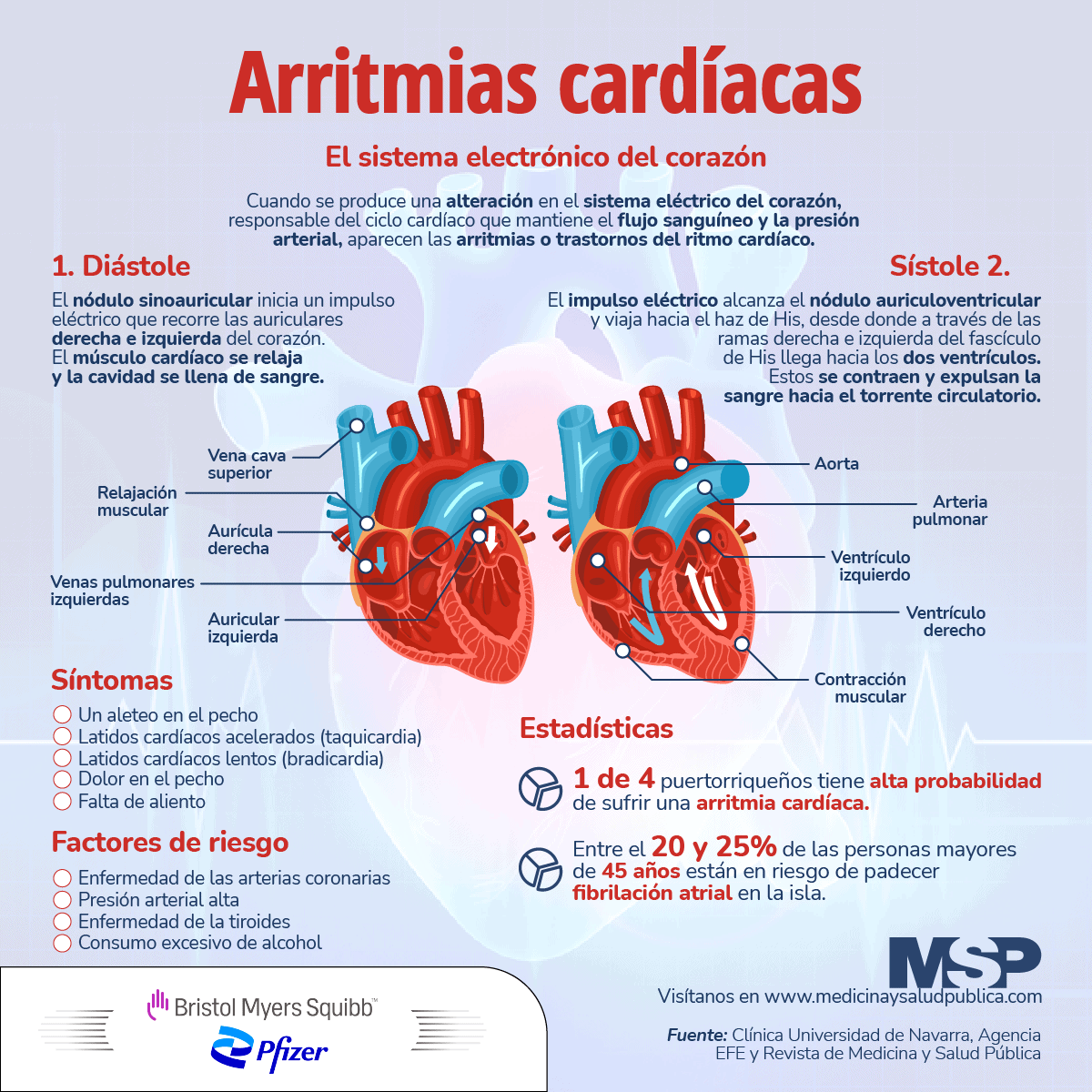 Tipos De Arritmias Cardiacas 8061