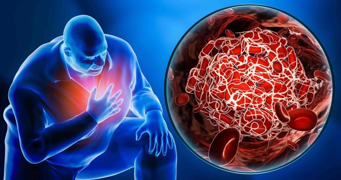 Estudio alerta sobre riesgos cardiovasculares 12 meses después de contagio por COVID-19