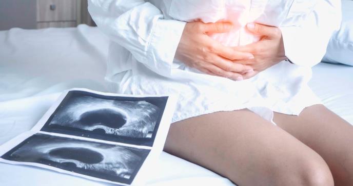Nuevos tratamientos de la endometriosis brindarán mejor ayuda tanto a médicos como a pacientes