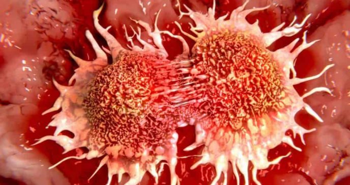 Mujeres con mayor riesgo de eventos adversos graves por la terapia contra el cáncer