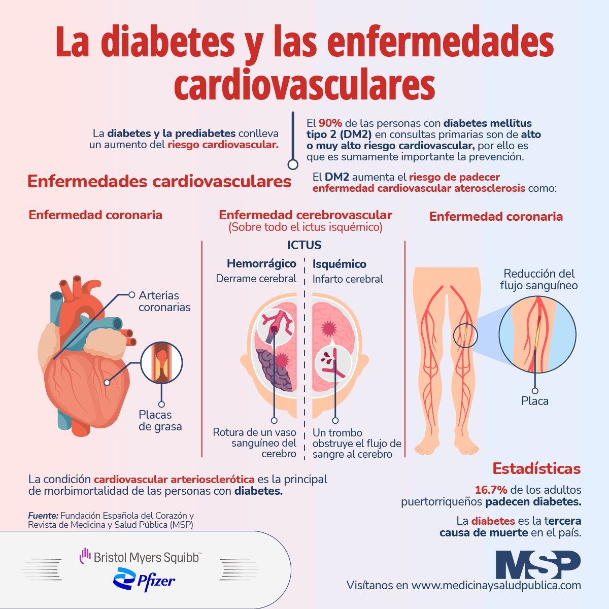 mil traducir obvio La diabetes y las enfermedades cardiovasculares - Infografía