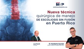 Nueva técnica quirúrgica de manejo de escoliosis sin fusión en Puerto Rico - #ExclusivoMSP