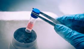Avances en el tratamiento de la diabetes con células madre ya no son ciencia ficción
