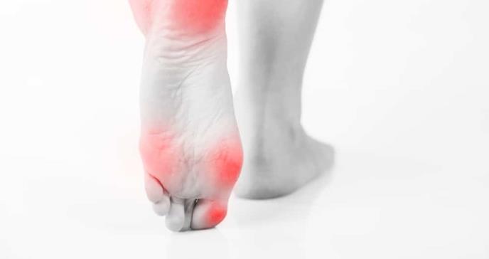 Recomendaciones para cuidar los pies de los pacientes con artritis reumatoide