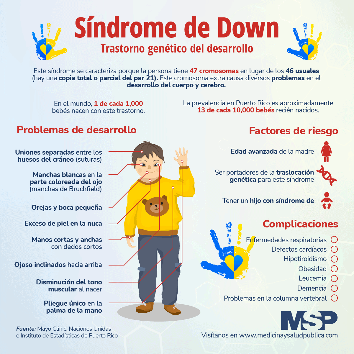 Síndrome De Down Infografía 8062