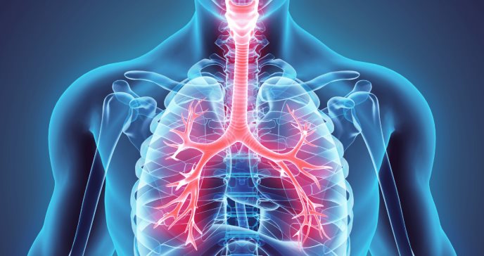 Un tratamiento biológico reduce el uso de corticosteroides en el asma severa, según estudio
