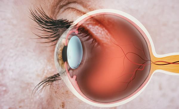 Cánceres retinianos, tipos de cáncer poco comúnes que generan visión borrosa y destellos de luz