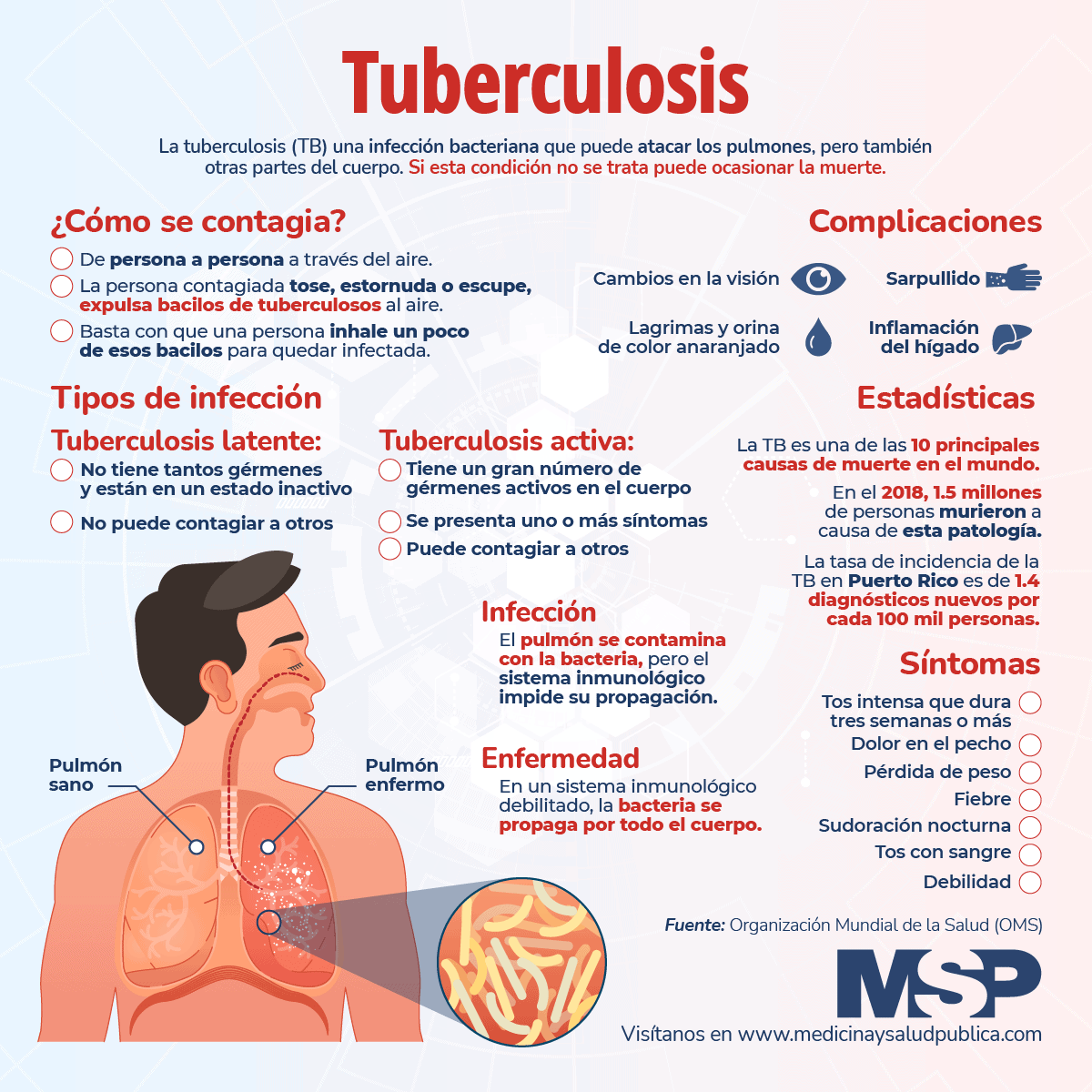Tuberculosis Infografía