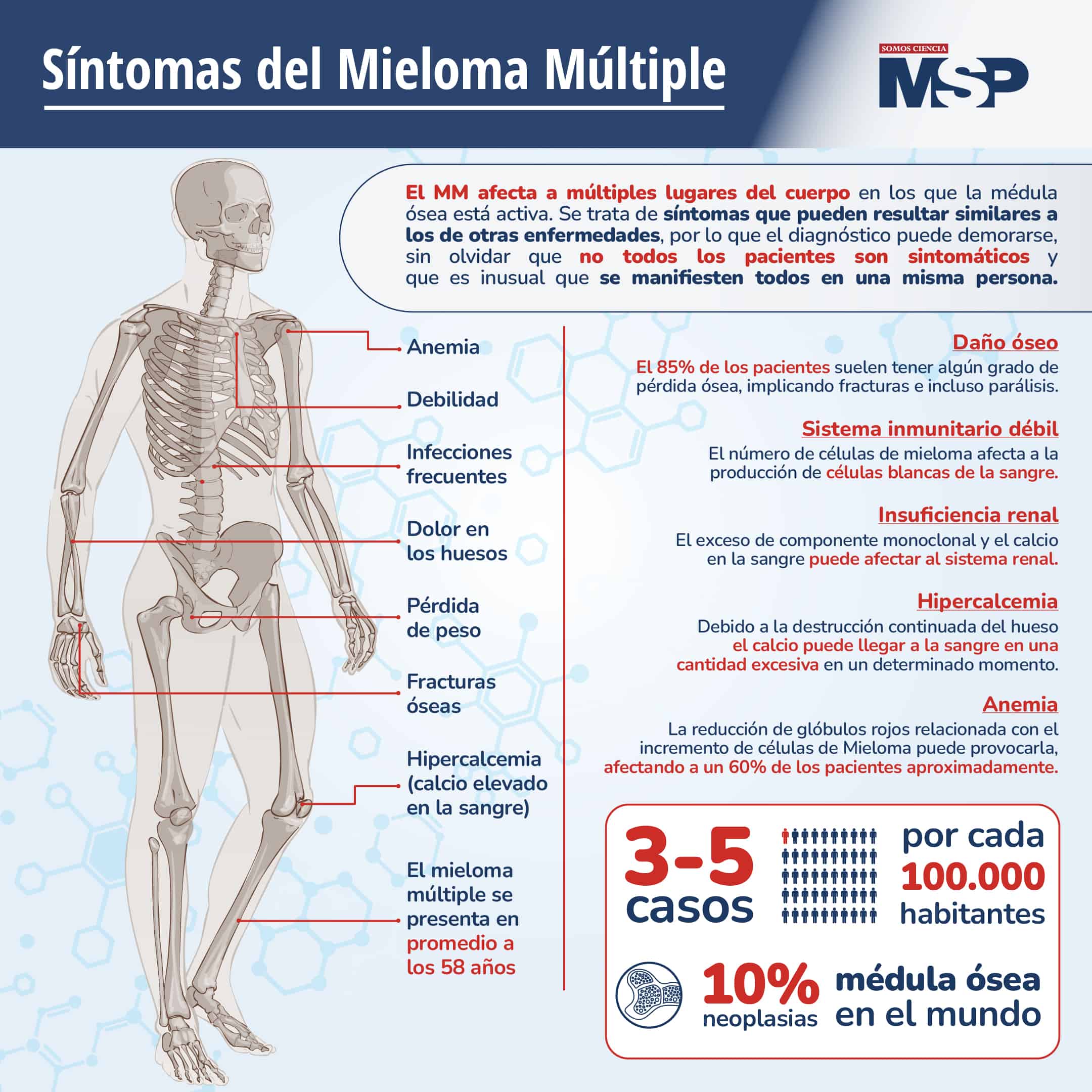 S Ntomas Del Mieloma M Ltiple Infograf A