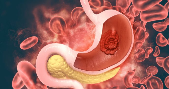 Guías médicas sugieren nuevos manejos de anticoagulantes en pacientes con problemas gastrointestinales