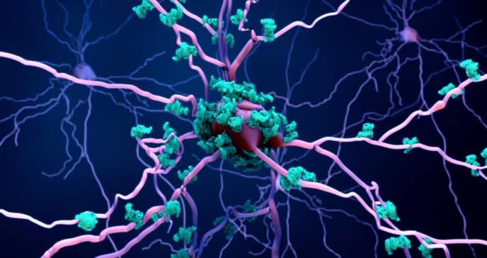 Proteína vinculada al Alzheimer podría contribuir a la propagación del melanoma al cerebro