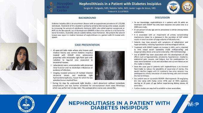 Hallan paciente con nefrolitiasis relacionada con diabetes insipidus y consumo de desmopresina