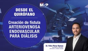 #DesdeElQuirofano I Creación de fístula arteriovenosa endovascular para diálisis