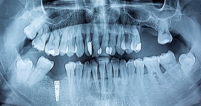 Enfermedades sistémicas y periodontitis: así se relacionan
