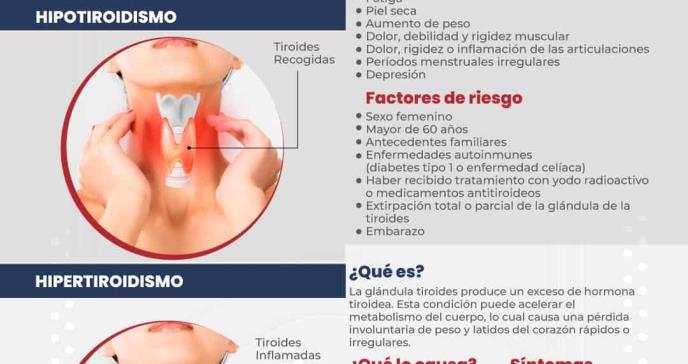 Hipotiroidismo e Hipertiroidismo - Infografía