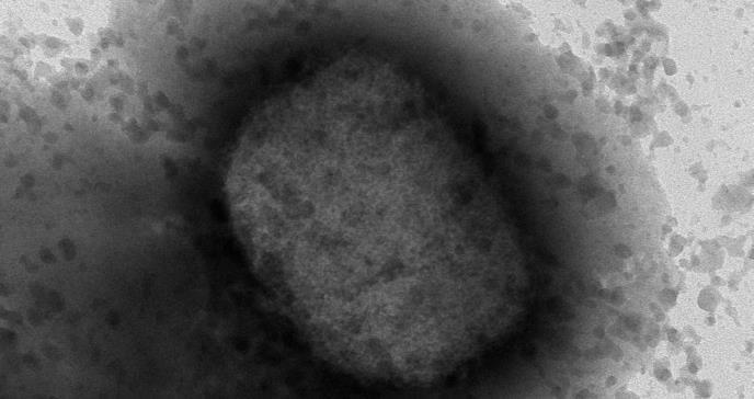 CDC detectó 2 cepas de viruela del mono en EE. UU.