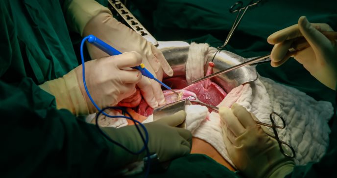 Primero en el mundo: Médicos trasplantan con éxito hígado humano tratado en una máquina