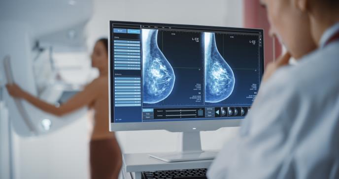 La seudocirrosis en el cáncer de mama podría ser indicio de metástasis hepáticas
