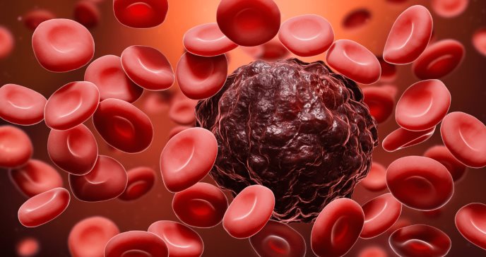FDA aprueba Liso-cel como tratamiento de segunda línea del linfoma de células B grandes