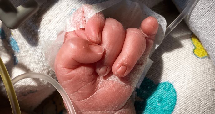 Bebés con malformación: Aunque sepas que van a abortar, tienes que ser siempre sincera