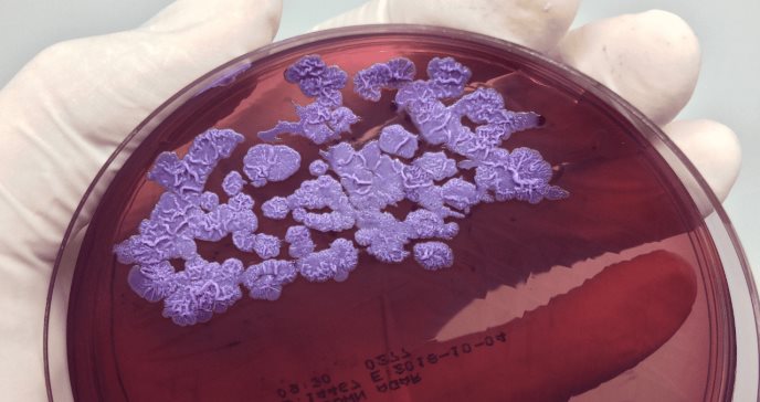 La peligrosa bacteria encontrada en EE. UU. que preocupa a las autoridades de salud del país