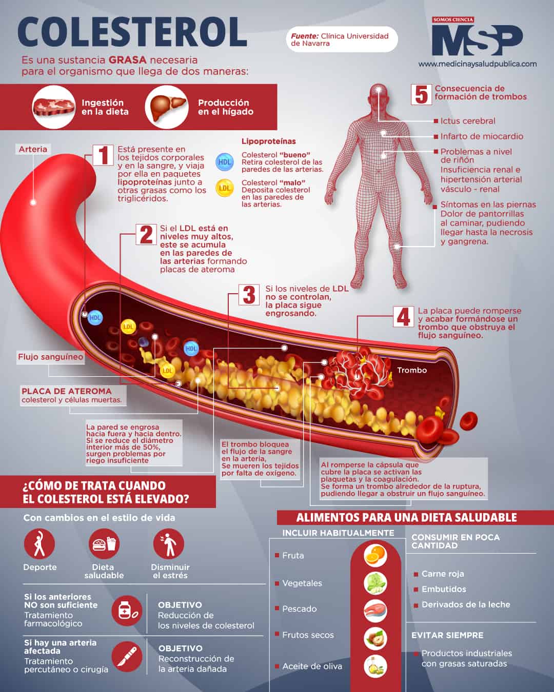 Colesterol Infografía 3618