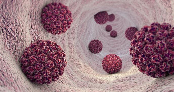Virus del Papiloma Humano podría desarrollar cáncer en hombres