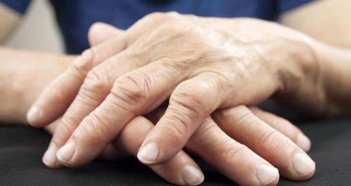La diferencia entre la artritis reumatoide y la artritis degenerativa