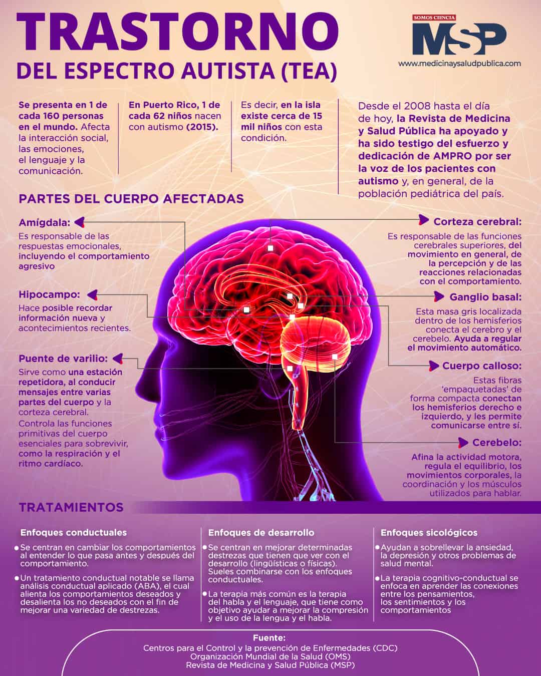 Signos y síntomas de los trastornos del espectro autista