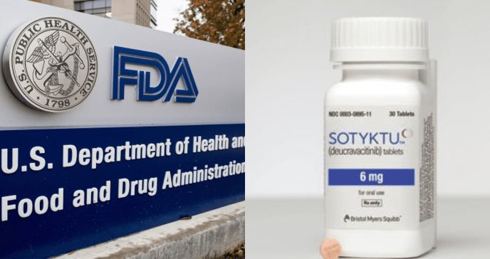 Administración de Drogas y Alimentos de EE. UU. aprueba Sotyktu de Bristol Myers Squibb para psoriasis