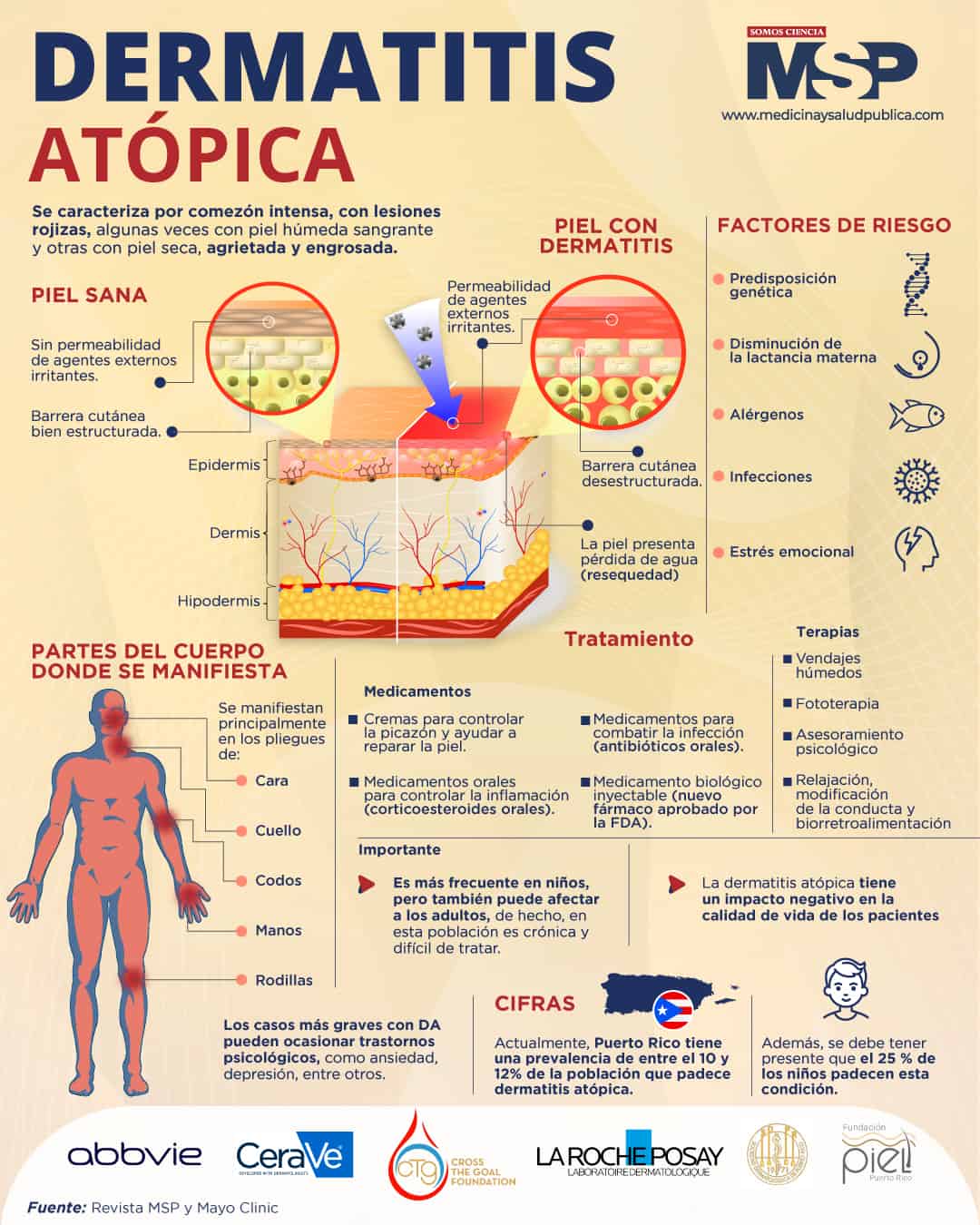 Dermatitis Atópica Infografía